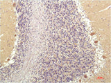 SGK1 Monoclonal Antibody