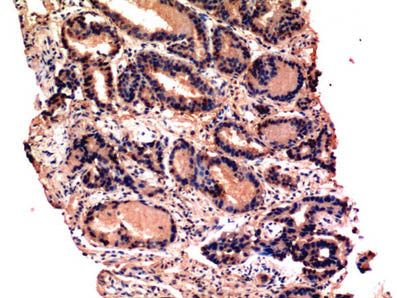 CASP3 Monoclonal Antibody