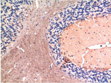 TGFB1 Monoclonal Antibody