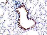 TGFB1 Monoclonal Antibody