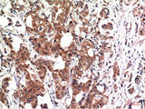 GSK3 Beta Monoclonal Antibody