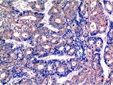 GSK3 Beta Monoclonal Antibody