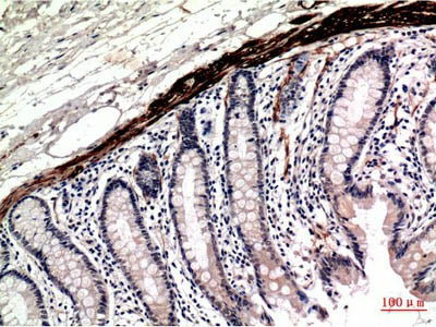 ACTA1 Monoclonal Antibody Store at -20°C