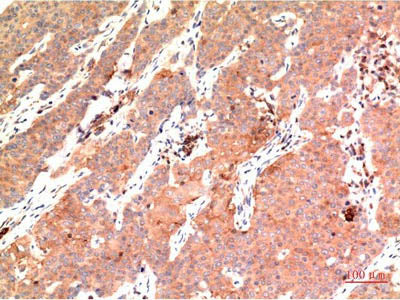 Epsilon Tubulin Monoclonal Antibody Store at -20°C