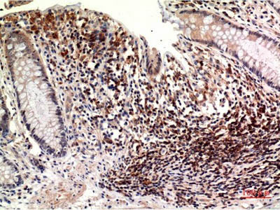 Epsilon Tubulin Monoclonal Antibody Store at -20°C