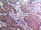 MMP2 Monoclonal Antibody
