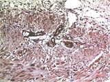 MMP2 Monoclonal Antibody