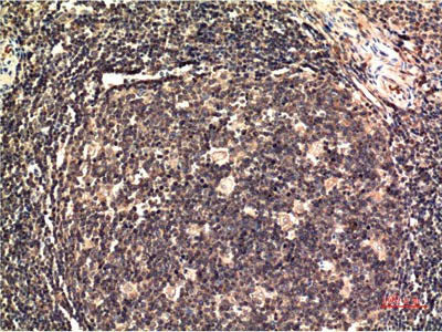 ERK 1 Monoclonal Antibody Store at -20°C Host Mouse