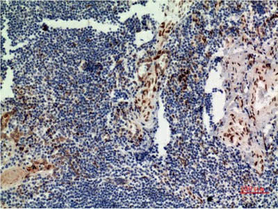 ERK 1 Monoclonal Antibody Store at -20°C