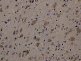 Cleaved-NOTCH1 (V1754) Polyclonal Antibody