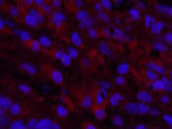 Cleaved-NOTCH1 (V1754) Polyclonal Antibody