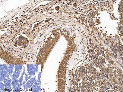 Cleaved-PARP1 (D214) Polyclonal Antibody