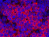 Cleaved-PARP1 (D214) Polyclonal Antibody