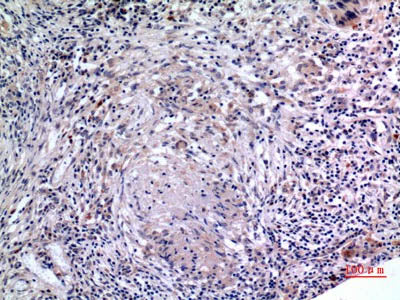 IL6 Polyclonal Antibody Store at -20°C