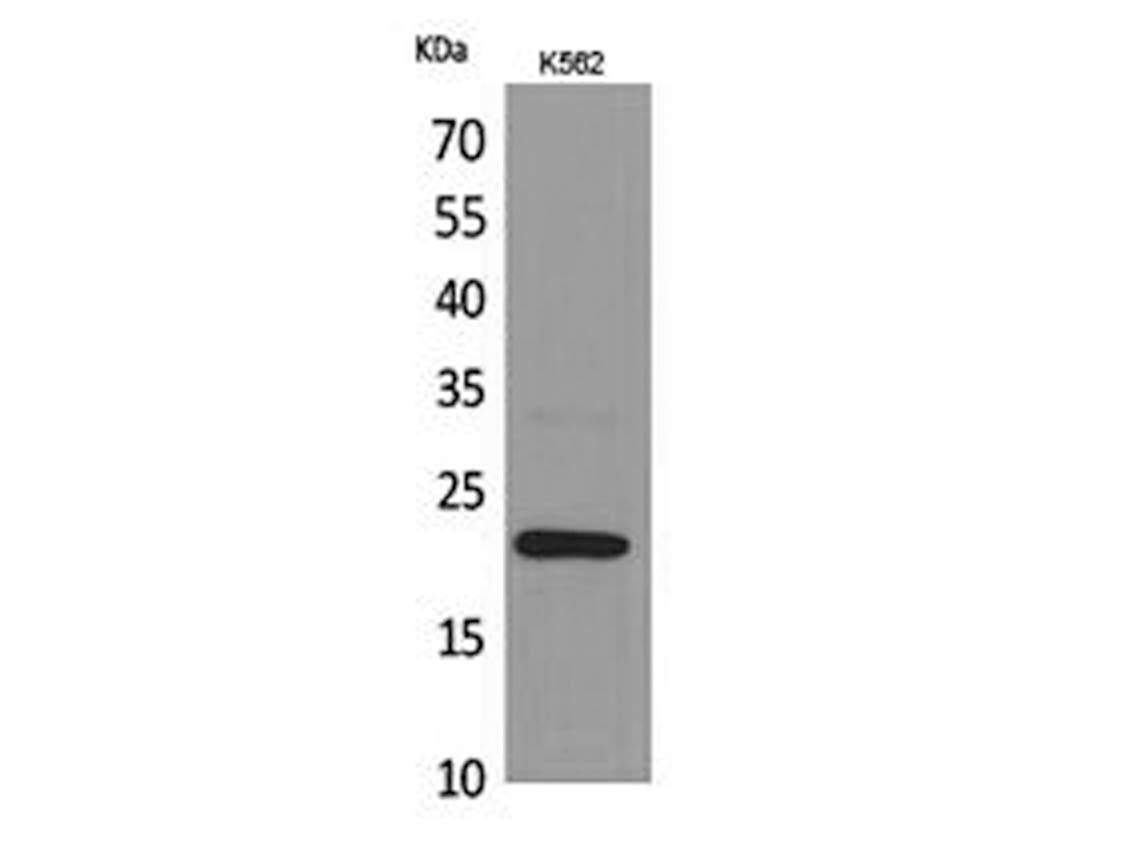 IL6 Polyclonal Antibody Store at -20°C