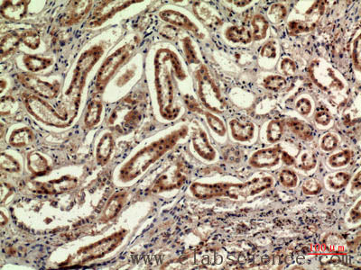 IDH1 Polyclonal Antibody Store at -20°C Host Rabbit