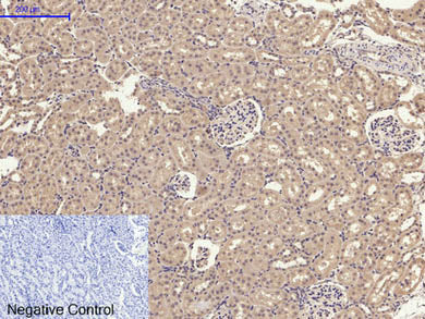 GLUT-4 Polyclonal Antibody Store at -20°C Host Rabbit