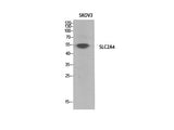 GLUT-4 Polyclonal Antibody Store at -20°C Host Rabbit