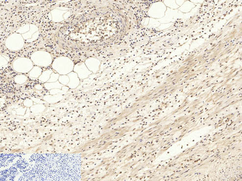 Pan-Akt Polyclonal Antibody Store at -20°C