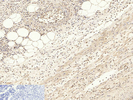 Pan-Akt Polyclonal Antibody Store at -20°C