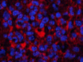 Pan-Akt Polyclonal Antibody Store at -20°C