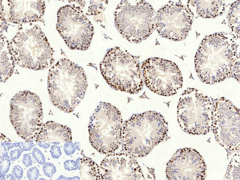 AMPK alpha1/2 Polyclonal Antibody