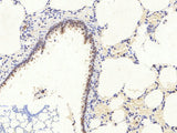 AMPK alpha1/2 Polyclonal Antibody