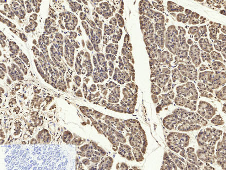 PYCARD Polyclonal Antibody Store at -20°C