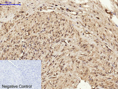 BRCA1 Polyclonal Antibody Store at -20°C Host Rabbit