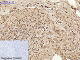 BRCA1 Polyclonal Antibody Store at -20°C Host Rabbit