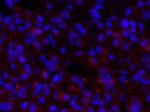 BRCA1 Polyclonal Antibody Store at -20°C Host Rabbit