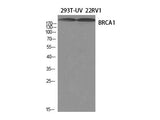 BRCA1 Polyclonal Antibody Store at -20°C Host Rabbit