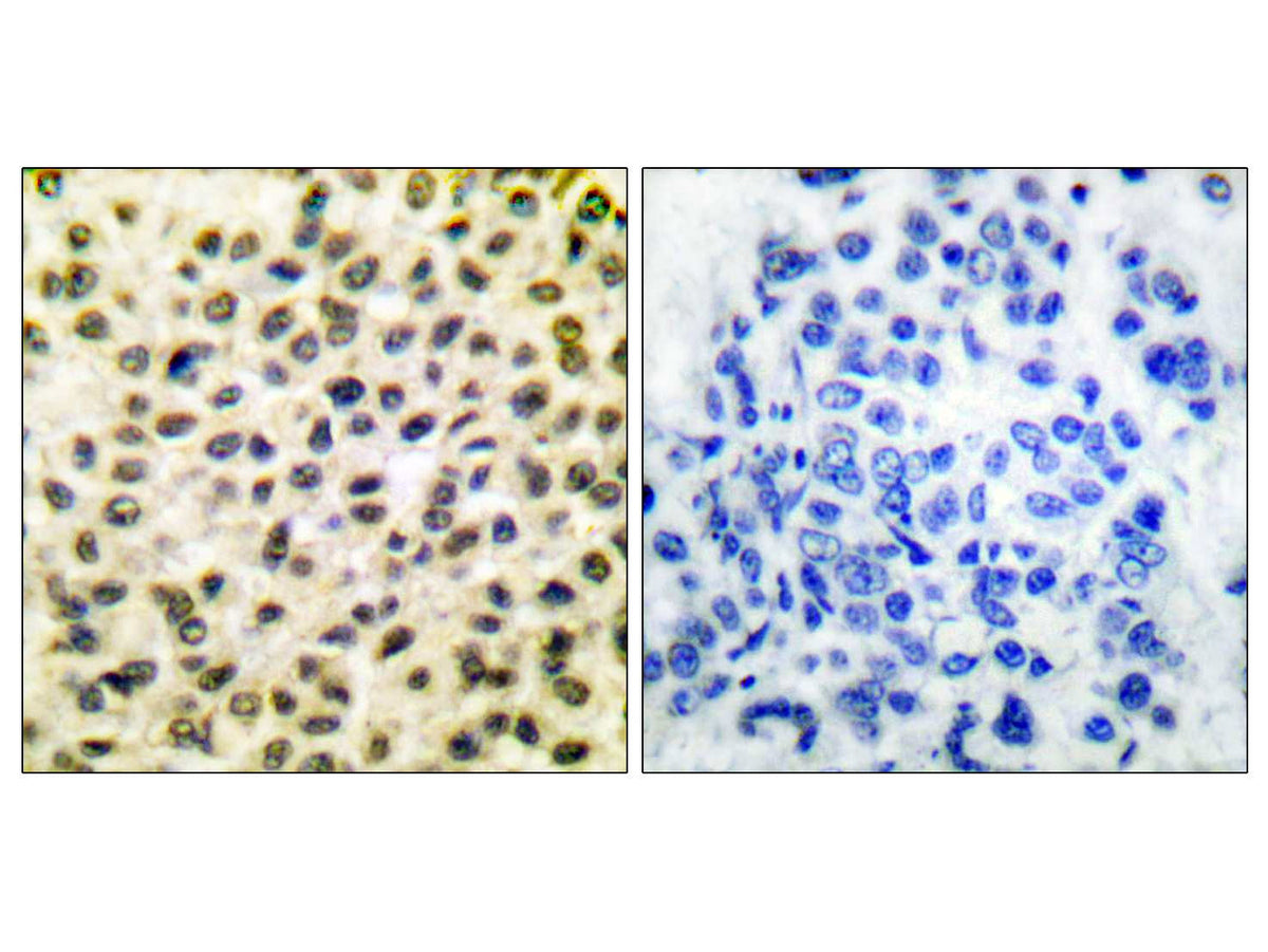 c-Fos Polyclonal Antibody Store at -20°C