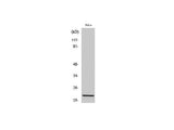 Claudin 1 Polyclonal Antibody Host Rabbit