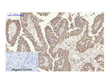 COX2 Polyclonal Antibody Host Rabbit