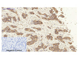 CK-19 Polyclonal Antibody Host Rabbit