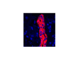 CK-19 Polyclonal Antibody Host Rabbit