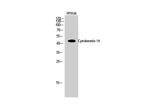 CK-19 Polyclonal Antibody Host Rabbit
