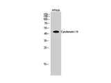 CK-19 Polyclonal Antibody Host Rabbit