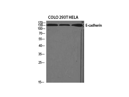 E-Cadherin Polyclonal Antibody Store at -20°C
