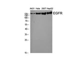 EGFR Polyclonal Antibody Store at -20°C