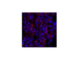 ERK 1/2 Polyclonal Antibody Host Rabbit
