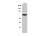 ER alpha Polyclonal Antibody Reactivity Human