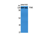 FAK Polyclonal Antibody Reactivity Human