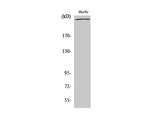 FLNA Polyclonal Antibody Reactivity Human
