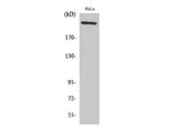 FN1 Polyclonal Antibody Reactivity Human