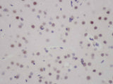 FOXO3 Polyclonal Antibody Reactivity Human