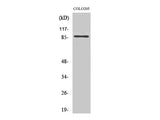 FOXO3 Polyclonal Antibody Reactivity Human