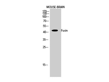 CXCR4 Polyclonal Antibody Reactivity Human