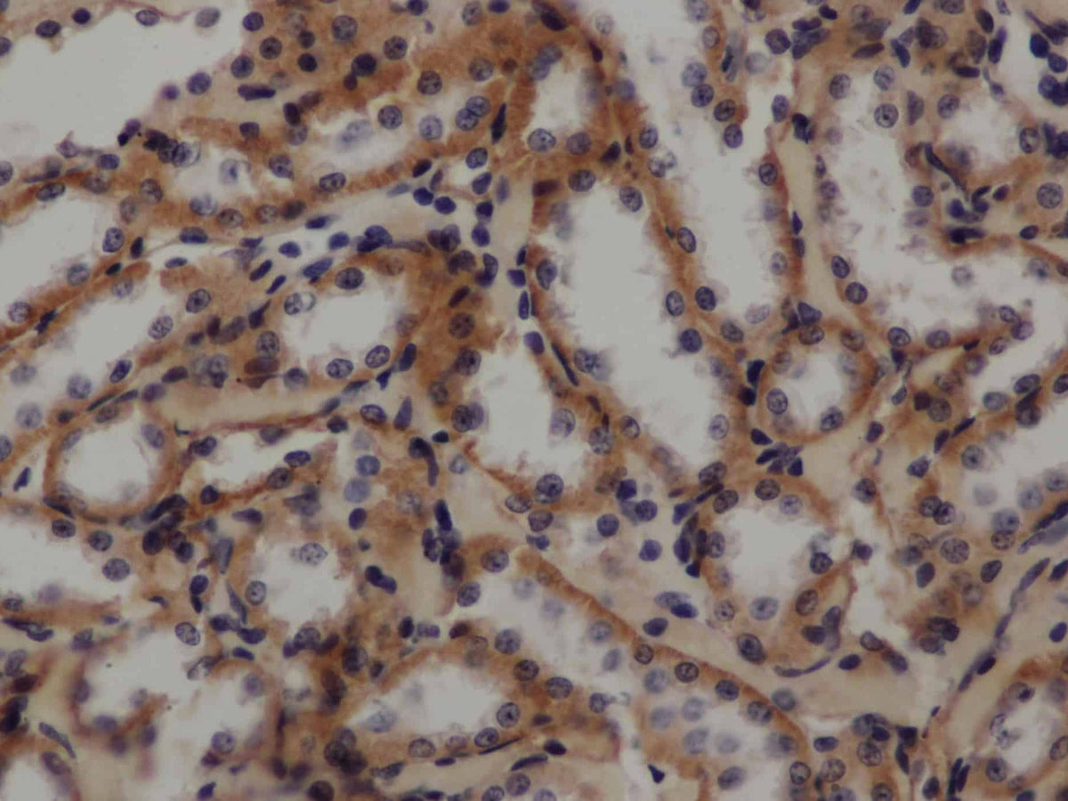 GLUT-1 Polyclonal Antibody Store at -20°C